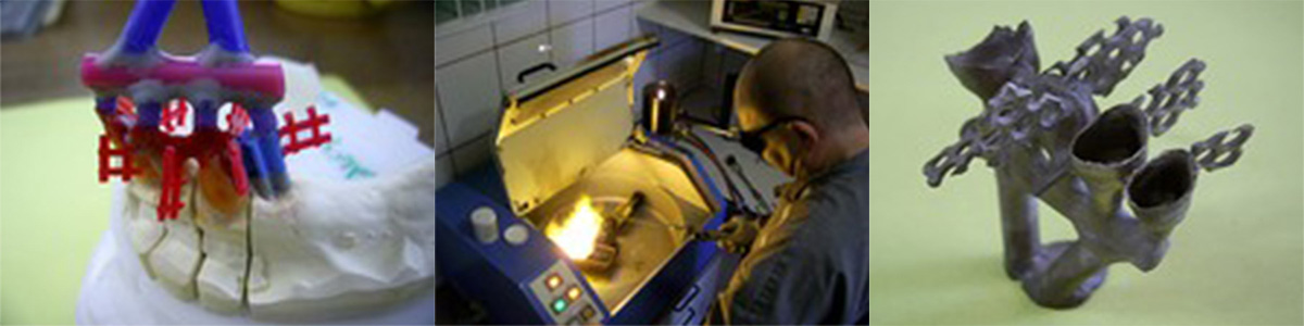 Gusstechnik